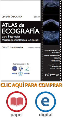 Atlas de ecografía para Patologías Musculoesqueléticas Comunes